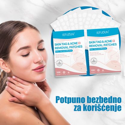 Pakovanje PRODAVANI flastera za uklanjanje bradavica.